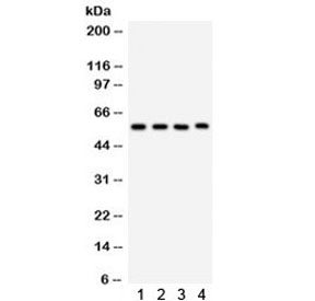 CYP1A1 Antibody Multi-Species WB. Western blot analysis of CYP1A1 expression was performed using anti-CYP1A1 antibody. Lane 1: rat lung lysate. Lane 2: mouse lung lysate. Lane 3: human placenta lysate. Lane 4: Jurkat cell lysate. CYP1A1 is a heme-containing cytochrome P450 monooxygenase that catalyzes Phase I xenobiotic metabolism and is strongly induced through aryl hydrocarbon receptor (AHR) signaling following exposure to environmental toxicants. A specific immunoreactive band is detected at approximately 58 kDa in all samples, consistent with the predicted molecular weight of CYP1A1. These results demonstrate cross-species reactivity and support the utility of CYP1A1 Antibody for studies of xenobiotic metabolism, drug metabolism, environmental toxicology, and AHR signaling.