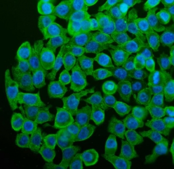 CYP1A1 Antibody Human Caco-2 IF. Immunofluorescent staining of FFPE human Caco-2 cells with CYP1A1 antibody (green) demonstrated predominantly cytoplasmic staining, consistent with the localization of CYP1A1 as a heme-containing cytochrome P450 monooxygenase involved in Phase I xenobiotic metabolism. CYP1A1 is induced through aryl hydrocarbon receptor (AHR) signaling and catalyzes the oxidative metabolism of environmental chemicals, drugs, and endogenous substrates. Nuclei were counterstained with DAPI (blue). HIER was performed by steaming sections in pH 6 citrate buffer for 20 minutes prior to staining. These results support the utility of CYP1A1 Antibody for studies of xenobiotic metabolism, AHR signaling, drug metabolism, and environmental toxicology.