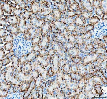 IHC staining of FFPE rat kidney tissue with ATP1A1 antibody. HIER: boil tissue sections in pH8 EDTA for 20 min and allow to cool before testing.