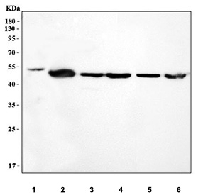 Western blot testing of 1) human HepG2, 2) rat liver, 3) rat lung, 4) rat kidney, 5) mouse kidney and 6) mouse ANA-1 cell lysate with ALDH2 / Acetaldehyde dehydrogenase 2 antibody. A single band is detected at approximately 50 kDa in all samples, which matches the reported observed molecular weight of endogenous ALDH2 (~48-56 kDa), despite its calculated mass of ~56 kDa.