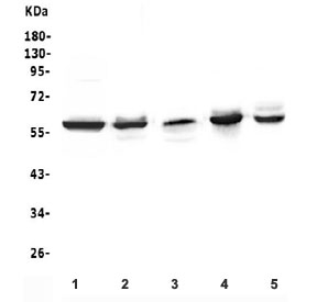 LCK Antibody Jurkat, Thymus and Spleen Western Blot. Western blot analysis of human Jurkat cells (lane 1), rat thymus (lane 2), rat spleen (lane 3), mouse thymus (lane 4), and mouse spleen (lane 5) using LCK Antibody / T-Cell Signaling Kinase Antibody demonstrates distinct bands at approximately 58 kDa, consistent with the expected molecular weight of LCK. LCK is a SRC family tyrosine kinase that serves as a critical initiator of T-cell receptor signaling, regulating pathways involved in lymphocyte activation, differentiation, proliferation, and adaptive immune responses. Detection of LCK in Jurkat cells and lymphoid tissues including thymus and spleen is consistent with its established role in T-cell development and immune signaling. The observed expression pattern supports the utility of LCK as a marker of T-cell-associated signal transduction and adaptive immune function.