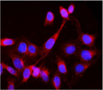 LCK Antibody U-2 OS Cell IF/ICC. Immunofluorescent staining of FFPE human U-2 OS cells using LCK Antibody / T-Cell Signaling Kinase Antibody demonstrates cytoplasmic and membrane-associated red fluorescence, consistent with expression of LCK. LCK is a SRC family tyrosine kinase that functions as a critical initiator of phosphorylation-dependent signaling pathways involved in lymphocyte activation, cellular communication, and immune signal transduction. The observed staining pattern is consistent with the intracellular localization expected for a non-receptor tyrosine kinase and supports the utility of this antibody for detection of LCK in immunofluorescence applications. Nuclei are counterstained with DAPI (blue). HIER: boil tissue sections in pH 6, 10 mM citrate buffer for 20 minutes and allow to cool before testing.