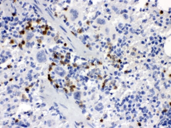 Immunohistochemistry of Csf-1 antibody in mouse spleen tissue. FFPE mouse spleen sections were subjected to heat-induced epitope retrieval by boiling in pH 6, 10 mM citrate buffer for 20 minutes followed by cooling prior to staining. Csf-1 antibody demonstrates HRP-DAB brown cytoplasmic staining in scattered splenic immune cells within the white pulp and perifollicular regions, while surrounding lymphoid populations show minimal background staining. The distribution is consistent with expression of Colony stimulating factor 1 in splenic stromal and myeloid-associated compartments.
