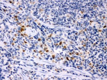 Immunohistochemistry of Csf-1 antibody in rat spleen tissue. FFPE rat spleen sections were subjected to heat-induced epitope retrieval by boiling in pH 6, 10 mM citrate buffer for 20 minutes followed by cooling prior to staining. Csf-1 antibody shows HRP-DAB brown cytoplasmic staining in scattered splenic immune cells within the white pulp and along trabecular regions, while the majority of surrounding lymphocytes display minimal background staining. The staining pattern is consistent with expression of Colony stimulating factor 1 in splenic stromal and myeloid cell populations.