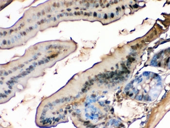 FABP Antibody Rabbit Polyclonal Mouse Intestine Immunohistochemistry. IHC testing of FFPE mouse intestine with FABP antibody. HIER: Boil the paraffin sections in pH 6, 10mM citrate buffer for 20 minutes and allow to cool prior to staining.