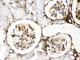 Galectin 1 Antibody Rat Kidney IHC. Immunohistochemical staining of FFPE rat kidney tissue using Galectin 1 antibody demonstrates cytoplasmic and membranous HRP-DAB brown staining within glomerular and tubular-associated cellular structures. The observed staining pattern is consistent with expression of Galectin-1 (LGALS1), a beta-galactoside-binding lectin involved in cell adhesion, immune regulation, extracellular matrix interactions, tissue remodeling, and glycan-mediated signaling pathways. Positive staining is evident within renal cellular compartments, supporting the known role of Galectin-1 in kidney physiology and cellular communication within the renal microenvironment. HIER: boil paraffin sections in pH 6, 10mM citrate buffer for 20 minutes and allow to cool prior to staining.