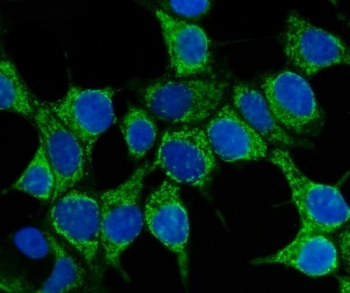 Immunofluorescent staining of FFPE human MCF7 cells with HSP70 antibody (green) and DAPI nuclear stain (blue). HIER: steam section in pH6 citrate buffer for 20 min.