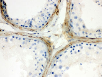 CLU Antibody Human Testis IHC. Immunohistochemistry testing of FFPE human testis with CLU antibody. HIER: Boil the paraffin sections in pH 6, 10mM citrate buffer for 20 minutes and allow to cool prior to staining.