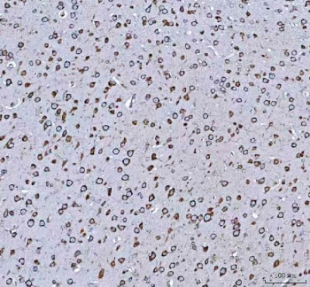 IHC staining of FFPE rat brain tissue with GRP78 antibody. HIER: boil tissue sections in pH8 EDTA for 20 min and allow to cool before testing.