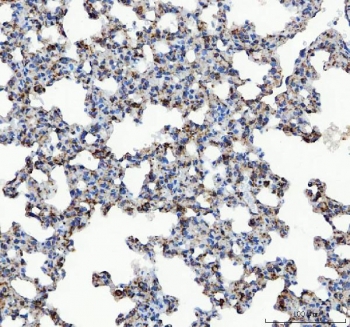 IHC staining of FFPE rat lung tissue with GRP78 antibody. HIER: boil tissue sections in pH8 EDTA for 20 min and allow to cool before testing.