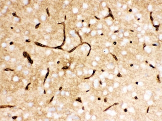 IHC testing of FFPE mouse brain with SLC2A1 antibody. HIER: Boil the paraffin sections in pH 6, 10mM citrate buffer for 20 minutes and allow to cool prior to staining.