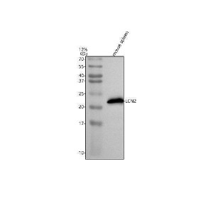 Lipocalin 2 Antibody detection in mouse spleen by WB. Western blot testing of mouse spleen tissue lysate with the Lipocalin 2 Antibody at 0.5 ug/ml. Lane 1 contains 30 ug of mouse spleen lysate separated by 5-20% SDS-PAGE under reducing conditions. A strong, well-defined band is detected at approximately 22 kDa, consistent with the expected molecular weight of LCN2. Minimal additional signal is visible across the remainder of the blot, demonstrating clean recognition of the target protein in mouse spleen. This result expands the western blot validation of this Neutrophil Gelatinase-Associated Lipocalin Antibody to mouse tissue.