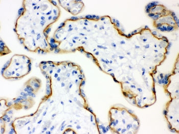 CDH1 Antibody Human Placenta IHC. Immunohistochemistry testing of FFPE human placenta with E-Cadherin/CDH1 antibody. HIER: Boil the paraffin sections in pH 6, 10mM citrate buffer for 20 minutes and allow to cool prior to staining.