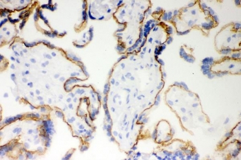 IHC testing of frozen human placenta with E-Cadherin/CDH1 antibody.
