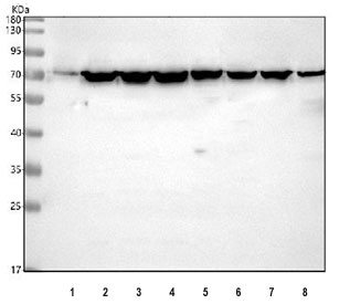 Ku70 Antibody Multi-Cell Line WB. Western blot analysis of human 1) LNCaP, 2) HeLa, 3) 293T, 4) HepG2, 5) Jurkat, 6) K562, 7) A549, and 8) A431 cell lysates using Ku70 Antibody detects a strong band at approximately 70 kDa across multiple epithelial and hematopoietic-derived cell lines, consistent with the predicted molecular weight of XRCC6 / Ku70. This DNA end binding protein antibody highlights broad expression of non-homologous end joining-associated DNA repair machinery and genomic stability pathways in diverse human cellular populations.
