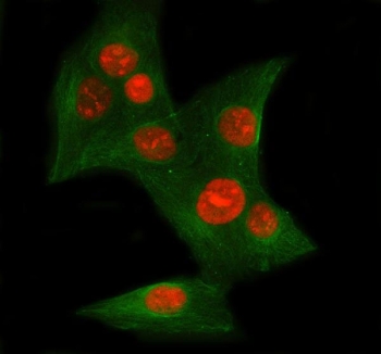 Ku70 Antibody U-2 OS Immunofluorescence. Immunofluorescent analysis of human U-2 OS cells stained with Ku70 Antibody demonstrates prominent nuclear-associated red fluorescence consistent with XRCC6 / Ku70 localization within DNA damage response and chromatin-associated repair compartments. Co-staining with Beta Tubulin mAb (green) highlights cytoskeletal architecture surrounding Ku70-positive nuclei. This DNA end binding protein antibody supports visualization of non-homologous end joining-associated repair signaling and genomic maintenance pathways in osteosarcoma-derived cells. HIER: steam section in pH6 citrate buffer for 20 min.