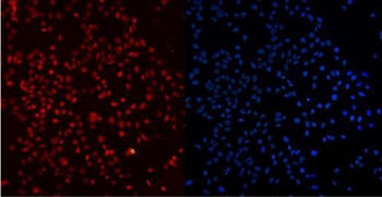 Ku80 Antibody U-2 OS Cell IF. Immunofluorescence analysis of formalin-fixed, paraffin-embedded human U-2 OS cells using Ku80 antibody. The antibody signal (red) shows predominant nuclear localization consistent with Ku80 (XRCC5) expression in actively cycling cells. DAPI (blue) marks nuclei, demonstrating strong overlap of Ku80 signal with nuclear regions. The staining pattern supports the role of Ku80 in coordinating DNA repair with cell cycle progression, particularly in proliferative cell populations.