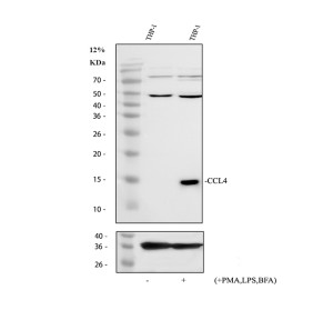 MIP1 Beta Antibody by WB in untreated and stimulated THP-1 cells. Western blot analysis of untreated and PMA/LPS/brefeldin A-stimulated human THP-1 cell lysates using MIP1 Beta Antibody. An immunoreactive band near 15 kDa is prominent in the stimulated sample and weak or undetectable in the untreated sample, consistent with increased CCL4-associated signal following inflammatory stimulation. Additional higher-molecular-weight immunoreactivity is present in both samples. This CCL4 Polyclonal Antibody targets a chemokine involved in macrophage activation and inflammatory signaling.