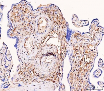 IHC staining of FFPE human placental tissue with Tissue Factor antibody. HIER: boil tissue sections in pH8 EDTA for 20 min and allow to cool before testing.