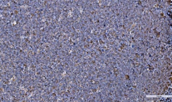 IHC staining of FFPE human tonsil with GRP94 antibody. HIER: boil tissue sections in pH8 EDTA for 20 min and allow to cool before testing.