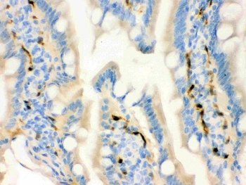 FABP4 Antibody Rat Intestine IHC. Immunohistochemistry testing of FFPE rat intestine with FABP4 antibody. HIER: Boil the paraffin sections in pH 6, 10mM citrate buffer for 20 minutes and allow to cool prior to staining.