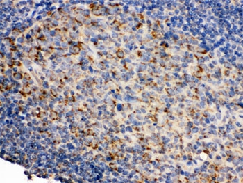 IHC testing of FFPE human tonsil with anti-CD19 antibody. HIER: Boil the paraffin sections in pH 6, 10mM citrate buffer for 20 minutes and allow to cool prior to staining.
