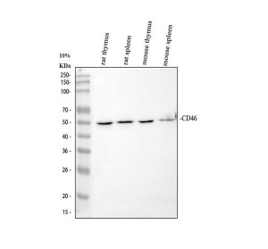 CD46 Antibody Rat and Mouse Immune Tissue WB. Western blot demonstrates detection of CD46 in rat thymus, rat spleen, mouse thymus, and mouse spleen tissue lysates. A distinct immunoreactive band is observed at approximately 50 kDa in all samples, consistent with the glycosylated forms of membrane cofactor protein, which commonly migrate above the predicted molecular weights of 33-44 kDa. The consistent detection across lymphoid tissues from both species reflects the broad expression of CD46 in immune-associated organs. This CD46 Antibody, also called Membrane Cofactor Protein Antibody, is suitable for studies of complement regulation, immune cell biology, and host defense mechanisms across rodent tissues.