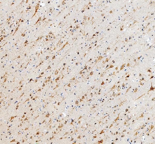 Kv1.2 Antibody Human Cerebral Cortex and Hippocampus IHC. Immunohistochemical staining of FFPE human cerebral cortex and hippocampus tissue with Kv1.2 antibody at 2 ug/ml. Heat-induced epitope retrieval (HIER) was performed by boiling tissue sections in pH 8 EDTA buffer prior to staining. Kv1.2 immunoreactivity is observed predominantly within neurons and the surrounding neuropil, consistent with the expected localization of this voltage-gated potassium channel involved in regulating neuronal membrane excitability and action potential repolarization. Cell nuclei are counterstained with hematoxylin (blue).
