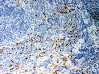 CD36 Antibody Rat Spleen IHC. Immunohistochemical staining of FFPE rat spleen demonstrates CD36 expression using a CD36 antibody. CD36, also known as Fatty Acid Translocase, is a multifunctional scavenger receptor involved in long chain fatty acid uptake, lipid metabolism, and immune regulation. Predominantly membranous and cytoplasmic staining is observed in splenic macrophages and other mononuclear cells, consistent with the established role of CD36 in phagocytosis, inflammation, and recognition of oxidized lipoproteins. Heat induced epitope retrieval was performed by boiling tissue sections in pH 6 10 mM citrate buffer for 20 minutes followed by cooling prior to staining. These results support the utility of CD36 Antibody for studies of scavenger receptor biology, lipid transport, immune responses, and metabolic disease.