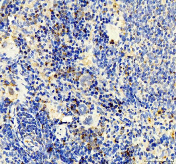 IHC staining of FFPE rat spleen tissue with IP10 antibody. HIER: boil tissue sections in pH8 EDTA for 20 min and allow to cool before testing.