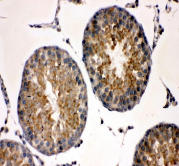 IHC staining of FFPE rat testis tissue with TCP1 alpha antibody. HIER: boil tissue sections in pH8 EDTA for 20 min and allow to cool before testing.