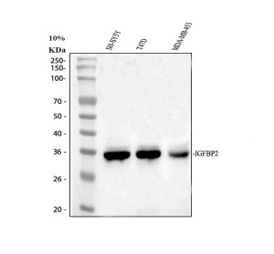 IGFBP2 Antibody Human Breast Cancer Cell WB. Western blot analysis was performed using IGFBP2 Antibody on human SH-SY5Y, T47D and MDA-MB-453 whole cell lysates (lanes 1-3, respectively). Samples (30 ug) were separated by 10% SDS-PAGE under reducing conditions and transferred to a nitrocellulose membrane. The membrane was incubated with the antibody at 0.5 ug/ml overnight at 4Â°C, followed by HRP-conjugated secondary antibody and ECL detection. A specific band was detected at approximately 35 kDa, consistent with the expected molecular weight of IGFBP2. This IGFBP2 Antibody demonstrates detection of IGFBP2 in human neuronal and breast cancer cell lysates.