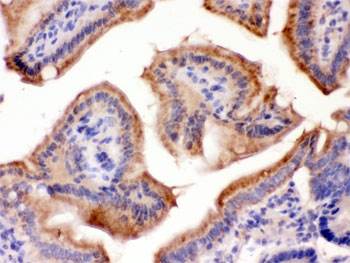 FUT1 Antibody Rat Intestine IHC. Immunohistochemistry staining of FFPE rat intestine using FUT1 Antibody demonstrates distinct membranous and apical cytoplasmic HRP-DAB brown staining throughout the intestinal epithelial lining. The staining pattern is consistent with expression of Fucosyltransferase 1 (FUT1), an alpha(1,2)-fucosyltransferase responsible for blood group H antigen biosynthesis and generation of fucosylated glycan structures on the cell surface. Intestinal epithelial localization is consistent with the known role of FUT1 in regulating mucosal glycosylation, epithelial differentiation, host-microbe interactions, and maintenance of gastrointestinal barrier function. The prominent staining observed along the luminal epithelial surface highlights tissues actively engaged in glycan biosynthesis and carbohydrate antigen expression. HIER: boil paraffin sections in pH 6, 10 mM citrate buffer for 20 minutes and allow to cool prior to staining.