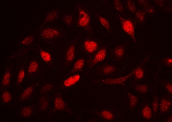 Immunofluorescence analysis of Cyclin A2 antibody in FFPE human U-2 OS cells. Cells demonstrate strong nuclear fluorescence signal consistent with Cyclin A2 localization in proliferating cells, with minimal cytoplasmic staining. The distribution pattern aligns with the known role of Cyclin A2 as a nuclear cell cycle regulator expressed during S phase and G2 phase. Heat-induced epitope retrieval was performed by steaming sections in pH 6 citrate buffer for 20 minutes prior to staining.