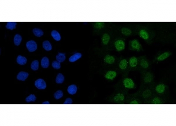 Immunofluorescent staining of FFPE human A431 cells with Cyclin A2 antibody (green) and DAPI nuclear stain (blue). HIER: steam section in pH6 citrate buffer for 20 min.