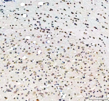 IHC staining of FFPE mouse cerebellum tissue with LMNB1 antibody. HIER: boil tissue sections in pH8 EDTA for 20 min and allow to cool before testing.
