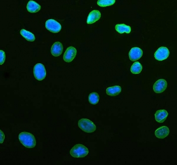 Immunofluorescent staining of FFPE human U-2 OS cells with LMNB1 antibody (green) and DAPI nuclear stain (blue). HIER: steam section in pH6 citrate buffer for 20 min.