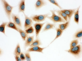 ICC testing of human A549 cells with COMT antibody.