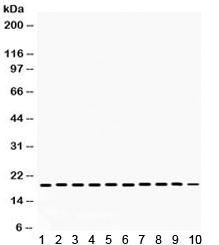 Western blot testing of 1) rat testis, 2) rat lung, 3) rat ovary, 4) mouse liver, 5) mouse brain, 6) mouse lung, and human 7) HeLa, 8) Jurkat, 9) A549, 10) SMMC lysate with Cofilin antibody. Expected/observed molecular weight ~19 kDa.