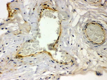 IHC testing of FFPE human placenta with Thrombin Receptor antibody. HIER: Boil the paraffin sections in pH 6, 10mM citrate buffer for 20 minutes and allow to cool prior to staining.