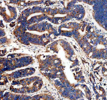 IHC staining of FFPE human colon tissue with MAOB antibody, HRP-secondary and DAB substrate. HIER: boil tissue sections in pH8 EDTA for 20 min and allow to cool before testing.