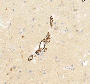 5HT2AR Antibody Human Brain IHC. Immunohistochemical staining of FFPE human brain tissue using 5HT2AR Antibody at 2 ug/ml. HIER was performed in pH 8.0 EDTA buffer. An HRP-conjugated goat anti-rabbit IgG secondary antibody with DAB substrate was used for detection. 5HT2AR Antibody, a Serotonin Receptor Antibody, demonstrates selective staining of neuronal processes and vascular-associated structures within the brain, consistent with the expected distribution of HTR2A in neural tissue.