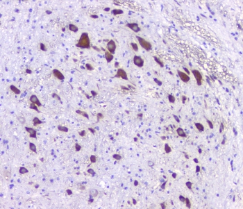 5HT2AR Antibody Rat Brain IHC. Immunohistochemical staining of FFPE rat brain tissue using 5HT2AR Antibody at 1 ug/ml. HIER was performed in pH 6 citrate buffer. An HRP-conjugated secondary antibody with DAB substrate was used for detection. 5HT2AR Antibody, a Serotonin Receptor Antibody, demonstrates strong cytoplasmic staining of neurons with minimal staining of the surrounding neuropil, consistent with the expected neuronal expression pattern of HTR2A.