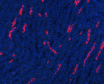 Immunofluorescent staining of FFPE rat kidney tissue with Aquaporin 1 antibody. HIER: boil tissue sections in pH8 EDTA for 20 min and allow to cool before testing.