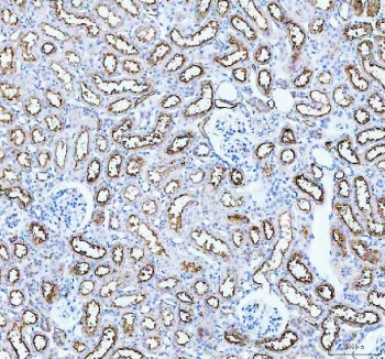 IHC staining of FFPE mouse kidney tissue with Aquaporin 1 antibody. HIER: boil tissue sections in pH8 EDTA for 20 min and allow to cool before testing.