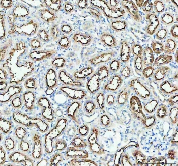 IHC staining of FFPE rat kidney tissue with Aquaporin 1 antibody. HIER: boil tissue sections in pH8 EDTA for 20 min and allow to cool before testing.