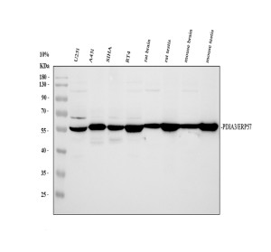 ERp57 Antibody Human, Mouse and Rat WB. Western blot analysis of ERp57 in human U251, A431, SiHa and RT4 cell lysates, rat brain and testis tissue lysates, and mouse brain and testis tissue lysates using ERp57 Antibody. Lane 1: U251; Lane 2: A431; Lane 3: SiHa; Lane 4: RT4; Lane 5: rat brain; Lane 6: rat testis; Lane 7: mouse brain; Lane 8: mouse testis. A specific band is detected at approximately 57 kDa, consistent with the expected molecular weight of ERp57/PDIA3. This ERp57 Antibody, also called a GRP58 Antibody, detects ERp57 across human, rat and mouse samples and supports studies of ER protein folding, disulfide bond formation and cellular proteostasis.