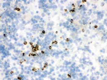 IHC testing of frozen rat spleen tissue with LCN2 antibody.