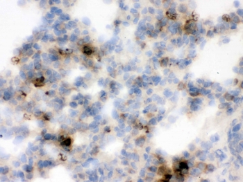 IHC testing of frozen rat lung tissue with LCN2 antibody.