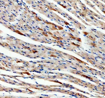 IHC staining of FFPE mouse heart tissue with SDHA antibody. HIER: boil tissue sections in pH8 EDTA for 20 min and allow to cool before testing.